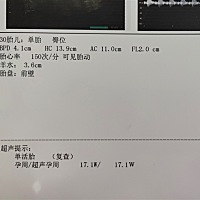 是男宝还是女宝？