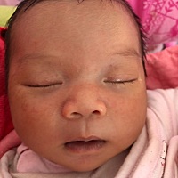 宝宝15天了，脸上突然长些小红点，怎么回事