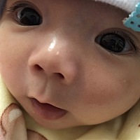 宝妈们 宝宝鼻子上 还有右脸上长的白疙瘩是怎么回事呀？鼻子上之前只长了一颗，现在又长了一颗在鼻子和...