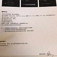 今天过去检查了，检查报告我看不懂，但医生说都挺好的，开心🥳