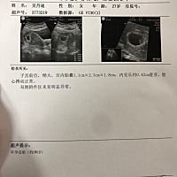 这个能看出是男宝还是女宝吗？