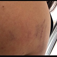 我以为婚姻对我而言就是安稳，我认识他的时候什么都没有，父母出车祸，我照顾了一年没有怨言，对我也挺...