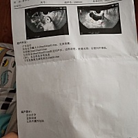 这个是怎么回事啊，我是属于意外怀孕，纠结了很久还是决定要这个孩子，结果检查出来这个 这个是怎么回事...