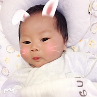 宝宝每次洗完脸红一块一块的怎么回事？