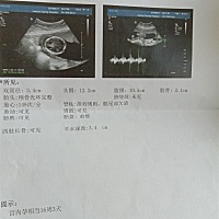 看看男宝还是女宝