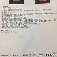 亲们给看下会是男孩还是女孩，头胎，很好奇哦！