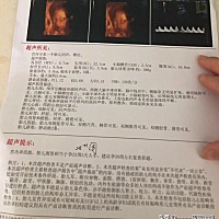 各位有经验的宝妈帮我看看男宝女宝啊