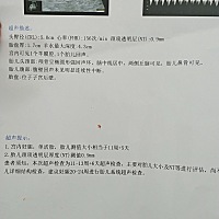 今天做NT老公跟着进去看看，结果啥也没看明白，就到小月亮像颗小豌豆一样弯在那，特好奇到底是乔治，还...