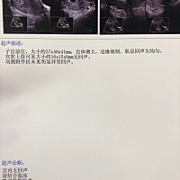 今天去医院检查了 医生说天数太少 让我过2周再去一次 姐姐们 帮我看下这是怀孕还是没怀孕啊 总是心里没...