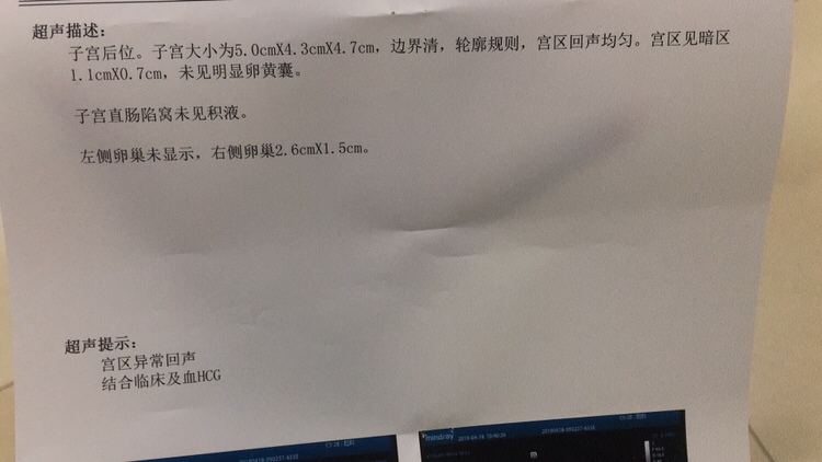 有看懂的亲嘛，这是怀孕了嘛？这是宫外孕嘛？