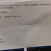 这是怀孕嘛？单子上显示什么都没有呀，是不是宫外孕呢