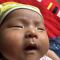 还没满月，昨天到今天长的，是不是湿疹呀？就脸上有，看到好心痛，怎么办？万能的朋友圈帮帮忙