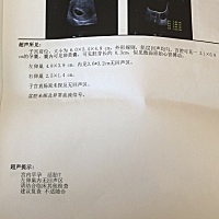能看出男孩女孩吗
