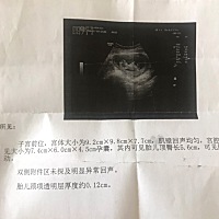 12+1今天NT顺利通过，有会看男女宝宝的宝妈么？麻烦帮忙看下…感谢🙏