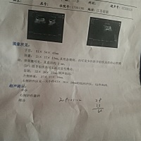 孕五周三天，留了一点褐色分泌物，去医院做b超下图，医生开了黄体酮没事吧 。