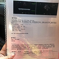 怀孕4个月宝妈们帮忙看看是男是女