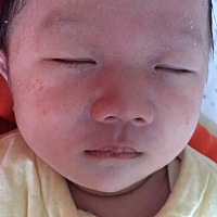 湿疹抹点什么药呢？宝宝一个月了。