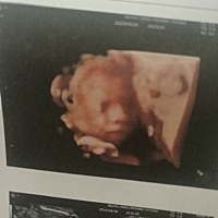 今天和我的小猪宝见面喽，好开心呦！看到脸的那一刻都激动的都掉眼泪了😛