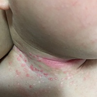 到底怎么样才能好，求各位妈妈支个招