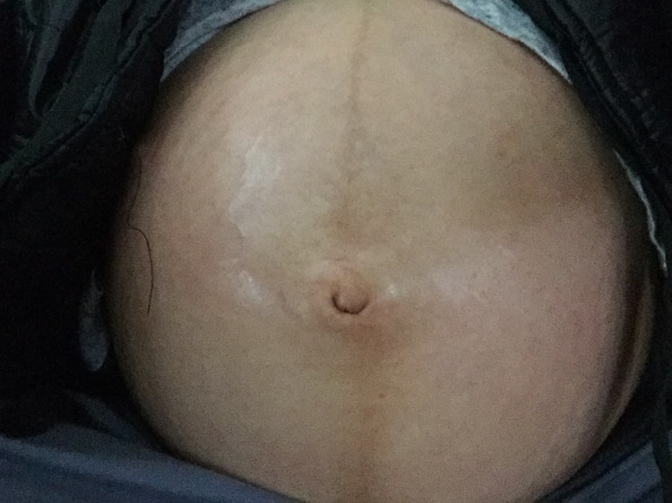 产前肚，快生的时候