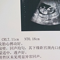NT一次通过，像男宝多还是女宝多