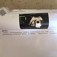 怀孕50天7周了，B超是28、18、30是男孩女孩呀？