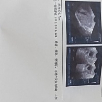 这是准备排卵了吗