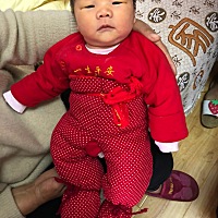 10天了，黄疸快下完了