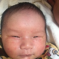 刚出生的时候皮肤光滑滑的，现在这两天像这玩意了怎么办呀？？？请教