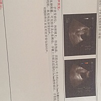 大家都说说同房多久，孕囊和胎芽有我的这么大？我的这个会不会是同房36天的大小