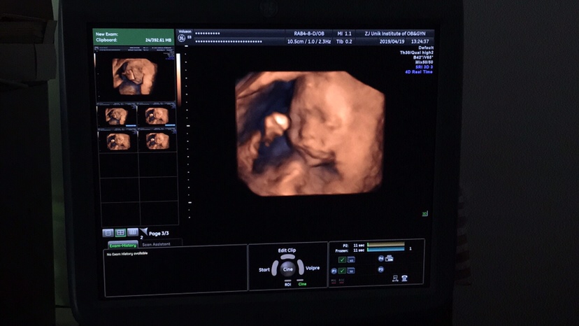 今天22周了哈🐷佩奇呵呵😄