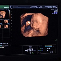 今天22周了哈🐷佩奇呵呵😄