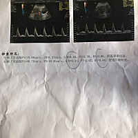 怀孕八周了，查出来说子宫动脉高，要打针，亲们有这种情况的吗