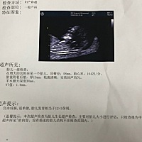 nt已通过，会看男女吗