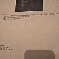 今天第54天，去医院做复查，医生说子宫偏大，有谁知道的帮我看看，也不知道怎么恢复，真害怕一直这样