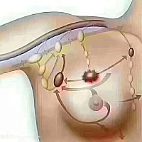 新生儿黄疸分为几种，大家知道吗？原因是什么🤔 欢迎加入👏给出不一样的答案……