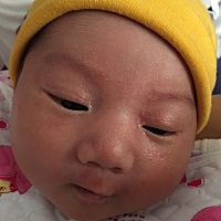 宝宝眼角那里是奶藓吗？