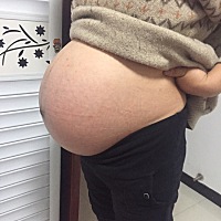 看肚子猜男宝还是女宝，宝宝已出生啦。 二胎宝宝。肚子超大。没有妊娠纹。孕期胖了50斤（体重160斤）没...