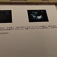 怀孕9周，见红有血块，有没有类似的？