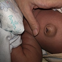 😭我宝宝肚脐是怎么了，怎么肚脐中间有一块小肉出来了😭有没有宝妈懂的？好担心啊