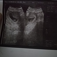 能看出来是男孩女孩吗 能看出女孩男孩吗