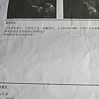 六周多四天，检查b超有卵黄囊没有胎芽胎心，医生说过一周在来复查，请问这个正常吗？