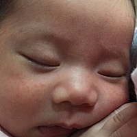 脸上红色小颗的疙瘩，是湿疹吗？一般用什么能擦好，每次喝奶脸上全是，是不是奶水引起的