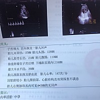 想知道是男宝还是女宝