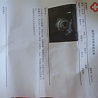 谁会看出男宝还是女宝。