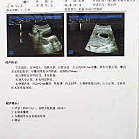 怀孕40 天，孕囊和宫腔有积血，还没查到胎芽，严重吗？