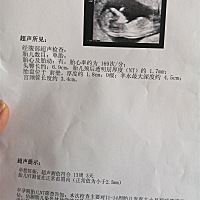 今天刚做了NT.有能看出男孩女孩的吗