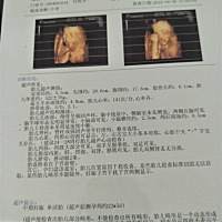 这个是男宝还是女宝有会看的吗