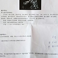 从B超单子能不能看出是男孩还是女孩