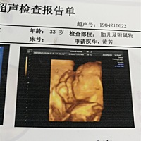 我做四维钱吃点甜的零食和巧克力一次拍完，你们可以带巧克力去哦(´-ω-`)我比自己周数大一周，羊水少，...